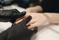 Cara Mengatasi dan Mencegah Infeksi Jamur di Kulit