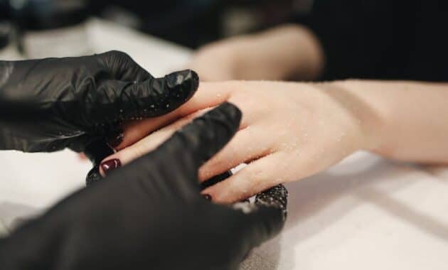 Cara Mengatasi dan Mencegah Infeksi Jamur di Kulit