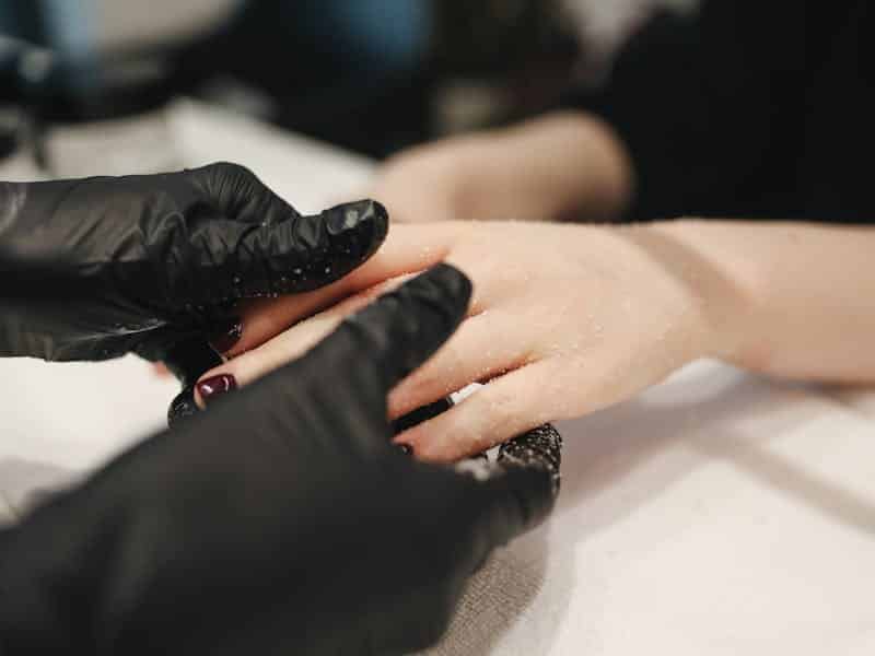 Cara Mengatasi dan Mencegah Infeksi Jamur di Kulit